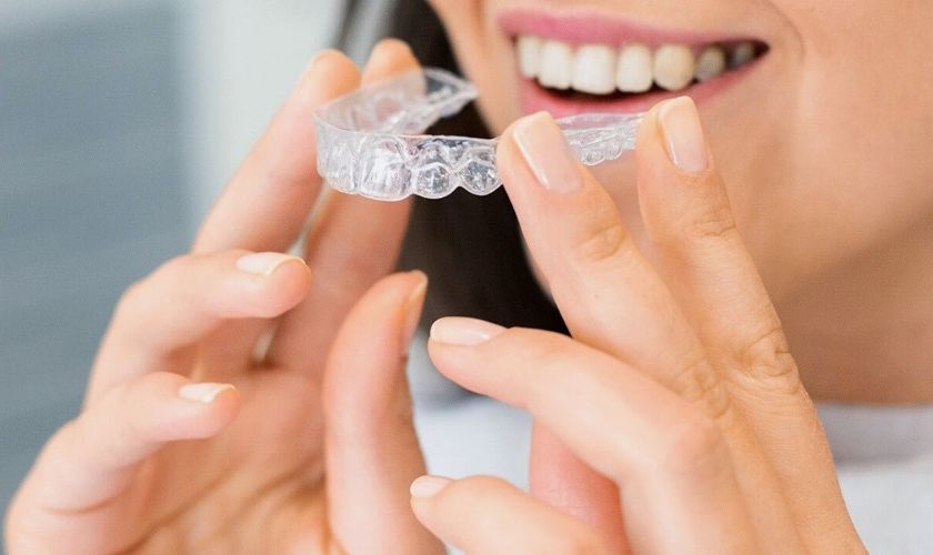 Invisalign dentist near you - theSimpleTooth - Dentist Foothill Ranch