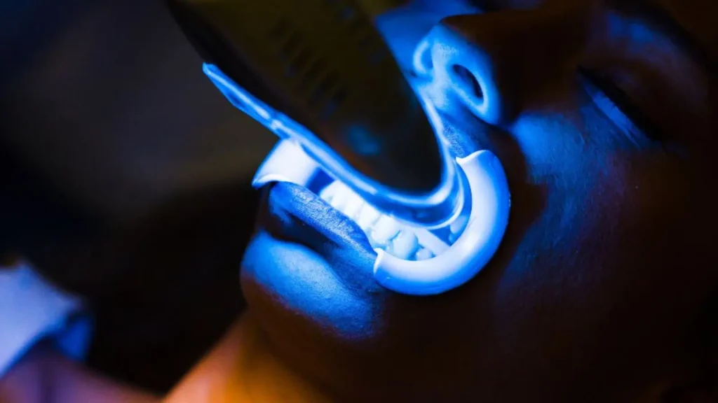 professional teeth whitening session