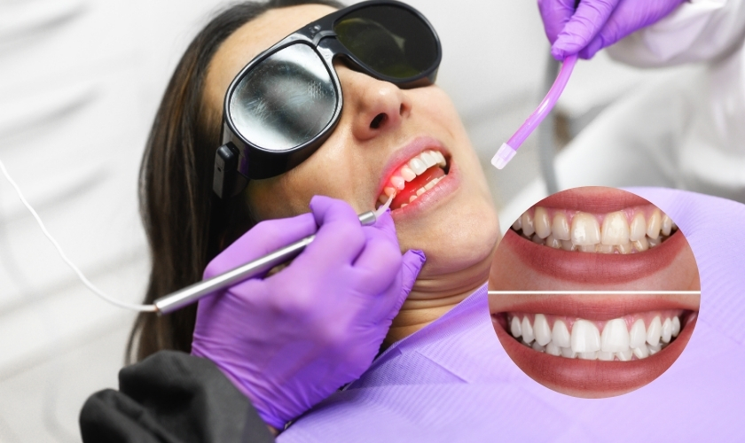 Is Laser Treatment Good For Teeth?