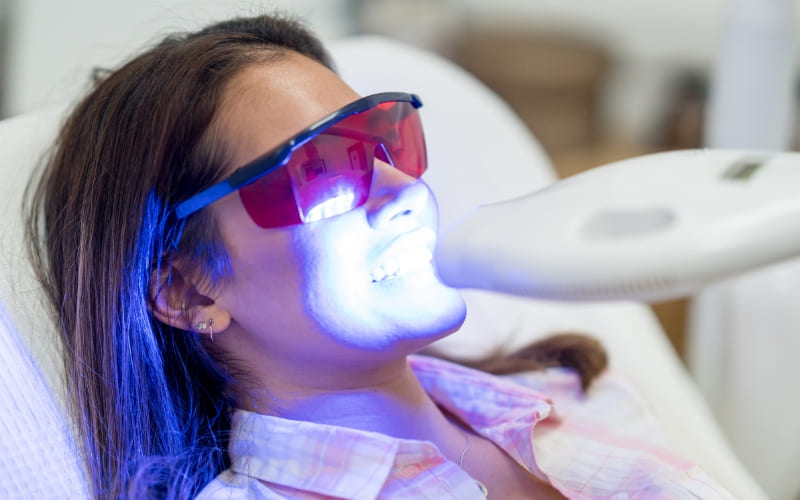 Is Laser Teeth Whitening Safe For Your Teeth